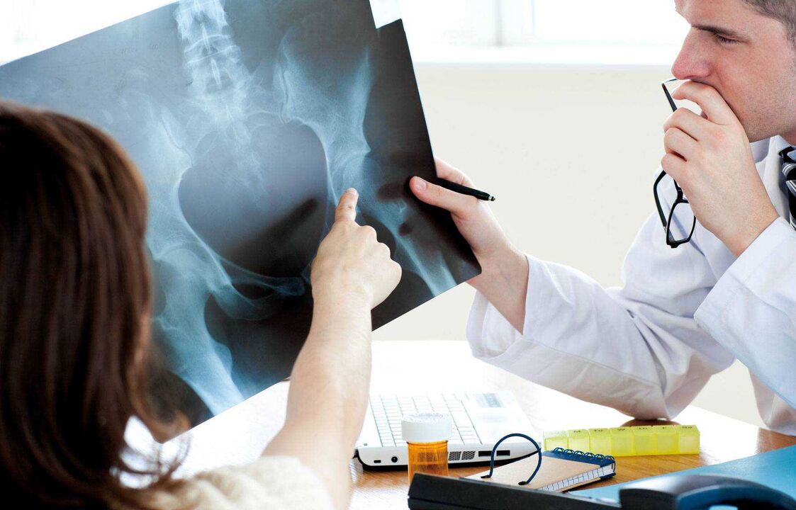 doctors examining x-ray for hip arthrosis